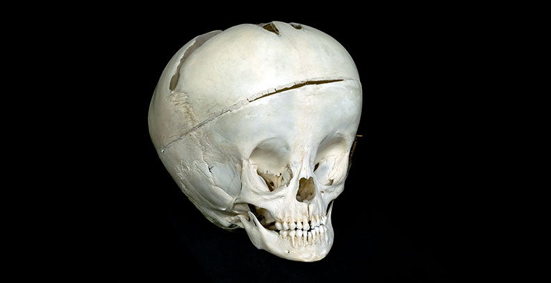 Antique skull from the Osteological Collection.