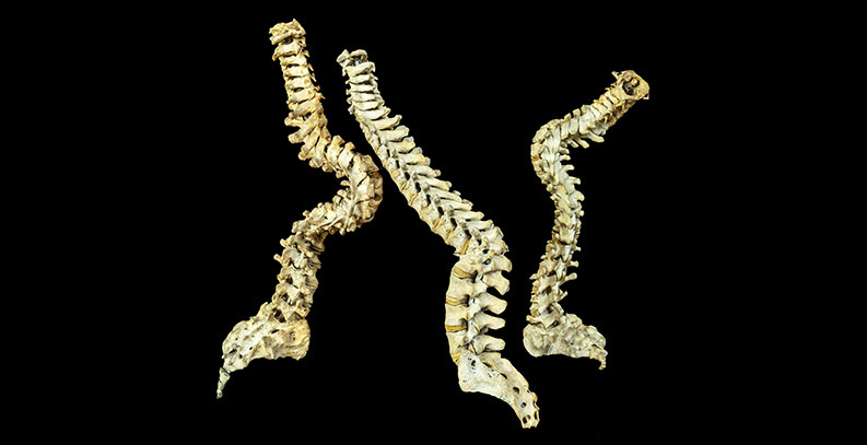 Three antique vertebrae from Osteological Collection.