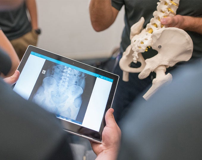Pelvic X-ray and pelvic spine model.